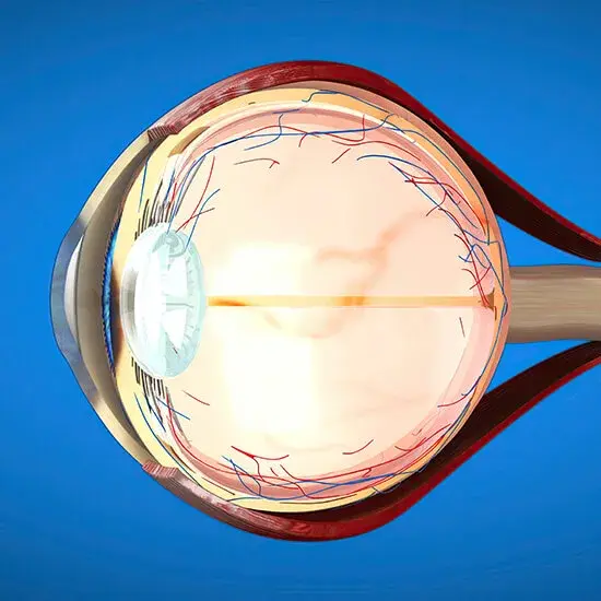 Retina
